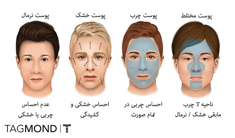 نحوه تشخیص نوع پوست