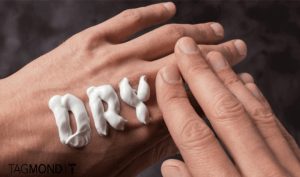 درمان خشکی پوست بدن