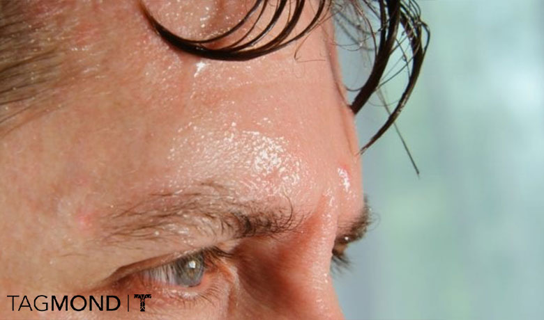 انواع تعریق